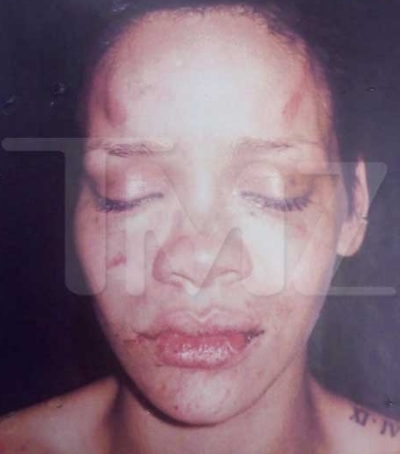rihanna chris brown beating. Chris Brown hit Rihanna I